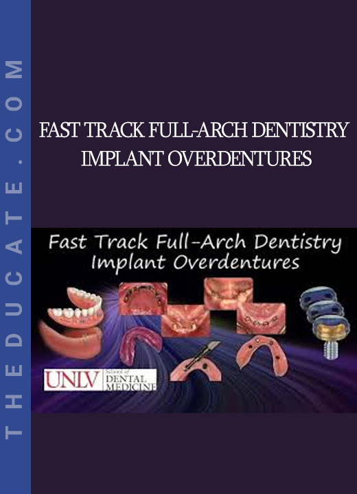 Fast Track Full-Arch Dentistry Implant Overdentures